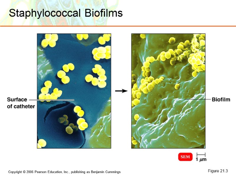 Staphylococcal Biofilms Figure 21.3